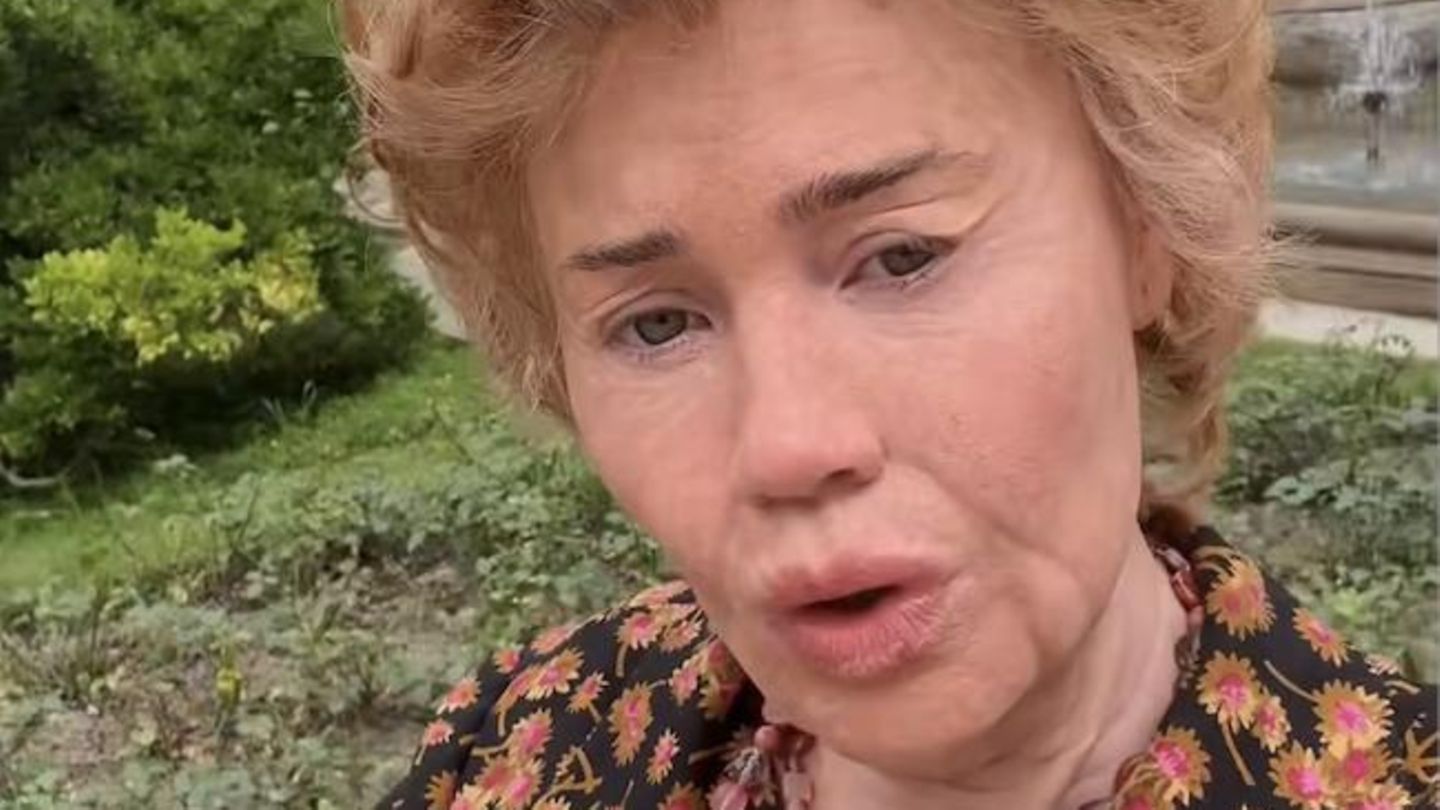 Film-Sch-nheiten-10-Silikonhautlappen-sp-ter-ist-diese-Moderatorin-v-llig-verwandelt