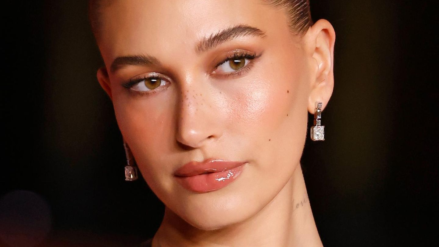 Hailey-Bieber-Statt-Botox-setzt-sie-auf-diese-Behandlung