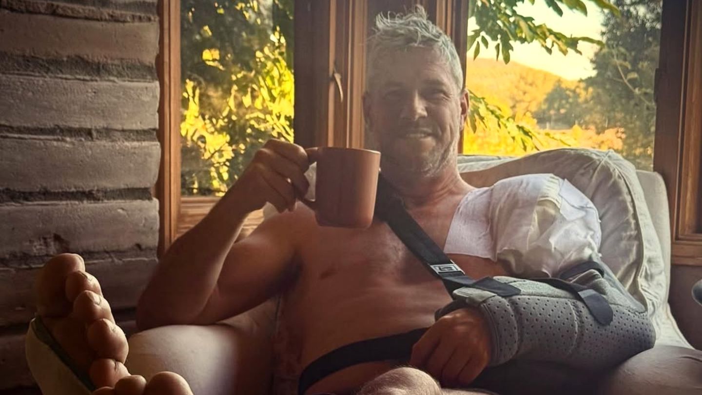 Ren-e-Zellweger-Partner-Ant-Anstead-musste-nach-Unfall-operiert-werden