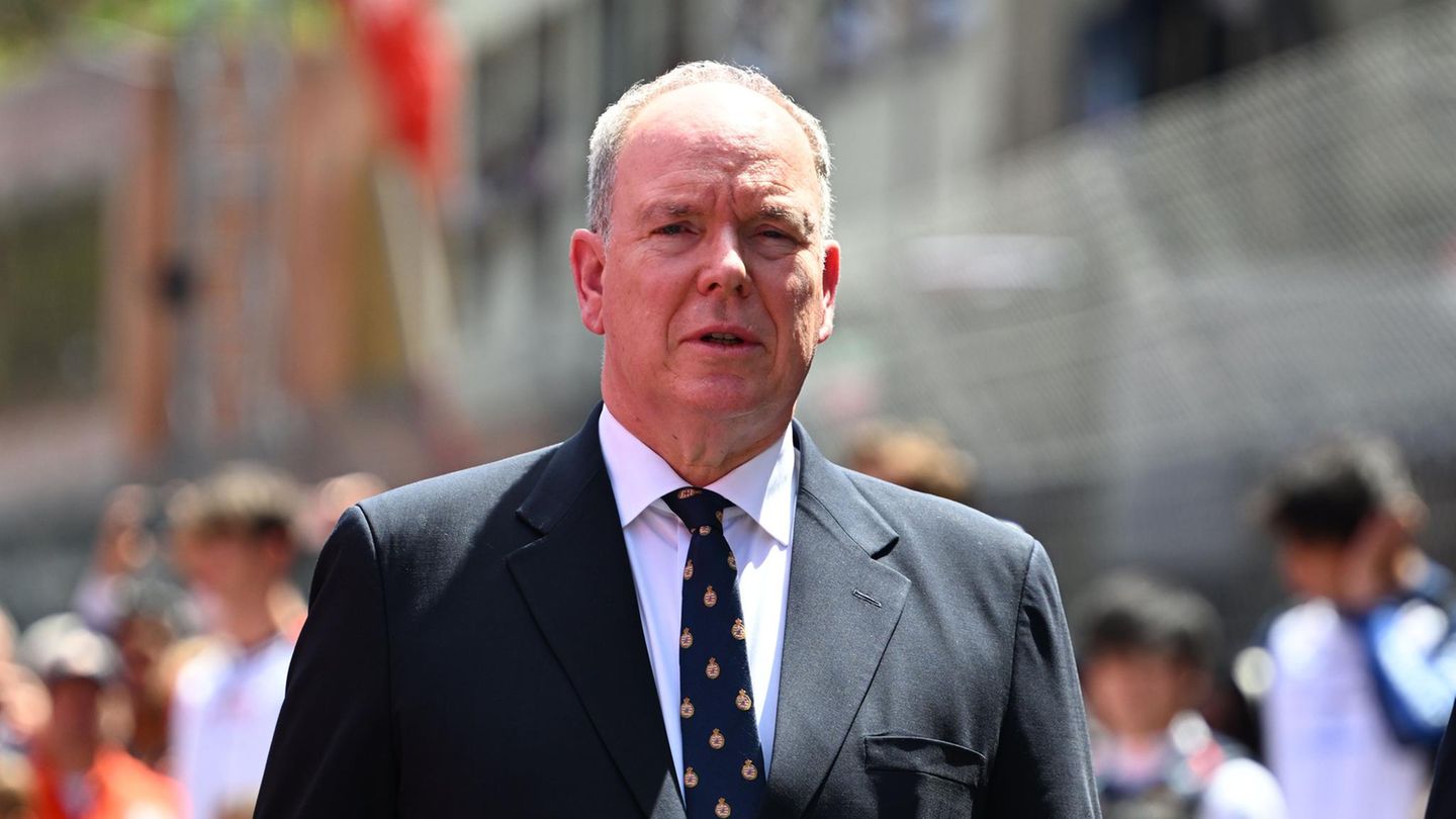 F-rst-Albert-F-rst-Albert-zeigt-sich-erstmals-nach-medizinischem-Eingriff-im-Gesicht