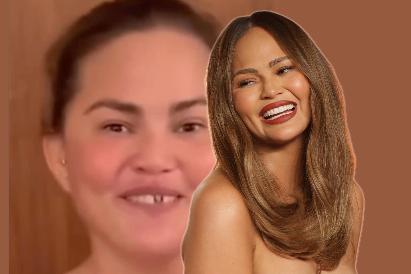 Unfall kurz vor Weihnachten: Chrissy Teigen zeigt sich ohne Vorderzahn
