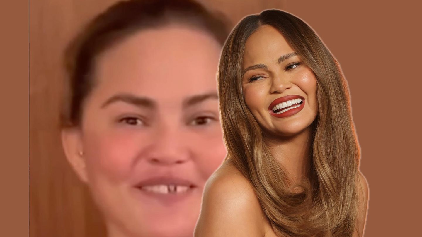 chrissy-teigen-zuckerstange-sorgt-f-r-zahn-krise-bei-chrissy-teigen