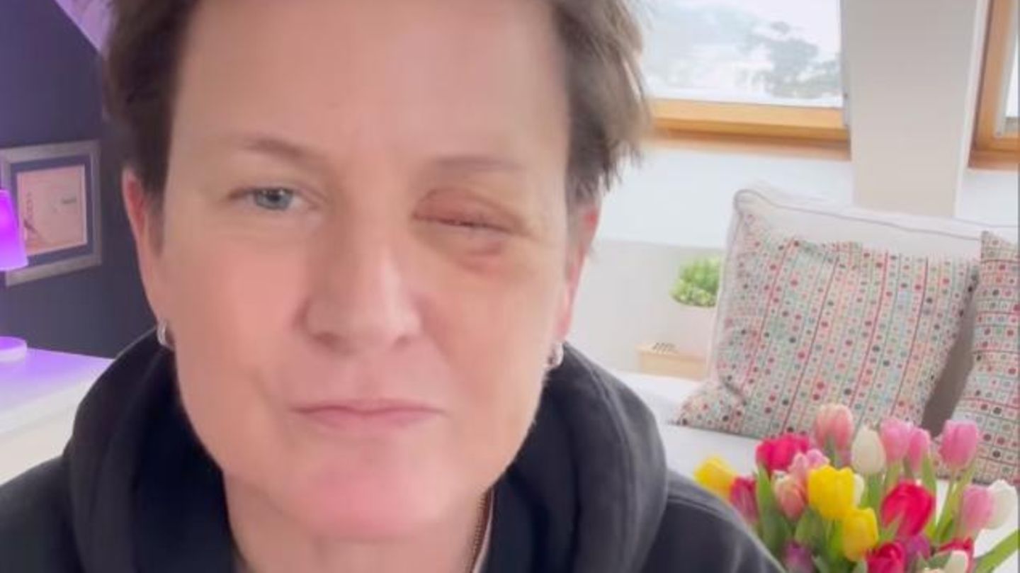 Vera-Int-Veen-Vera-Int-Veens-beste-Freundin-verliert-an-Silvester-Auge-wegen-B-ller