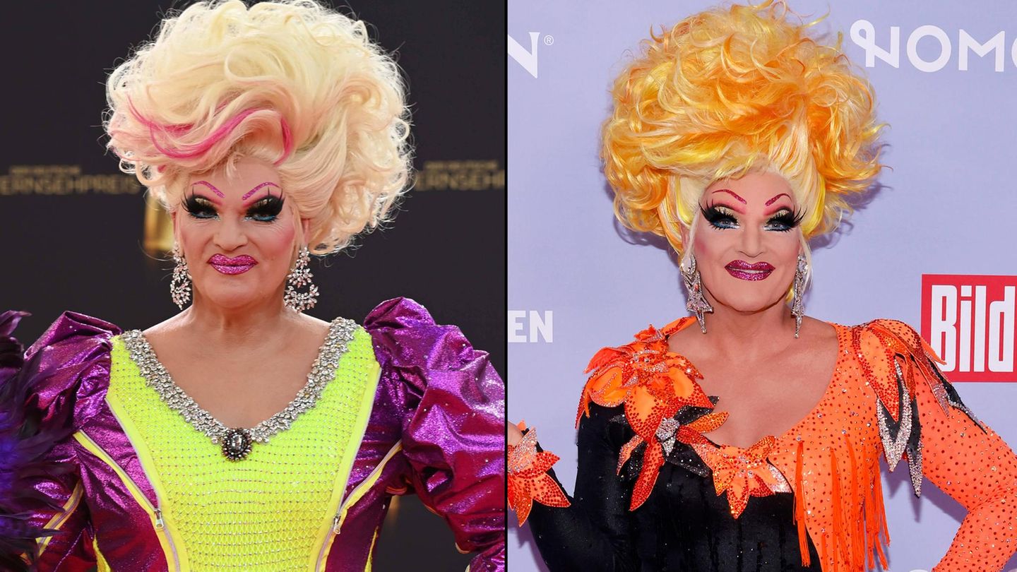 Olivia Jones: Jetzt spricht ihr Chirurg über die Mega-OP