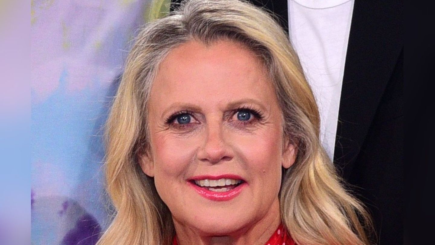 Barbara Schöneberger: Aufregung um ihren Haaransatz