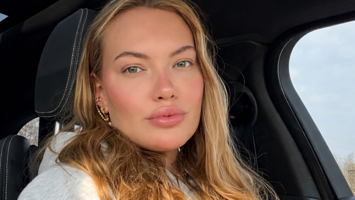 Stars-im-Beautywandel-So-sah-der-Reality-Star-vor-seinen-Beauty-Eingriffen-aus