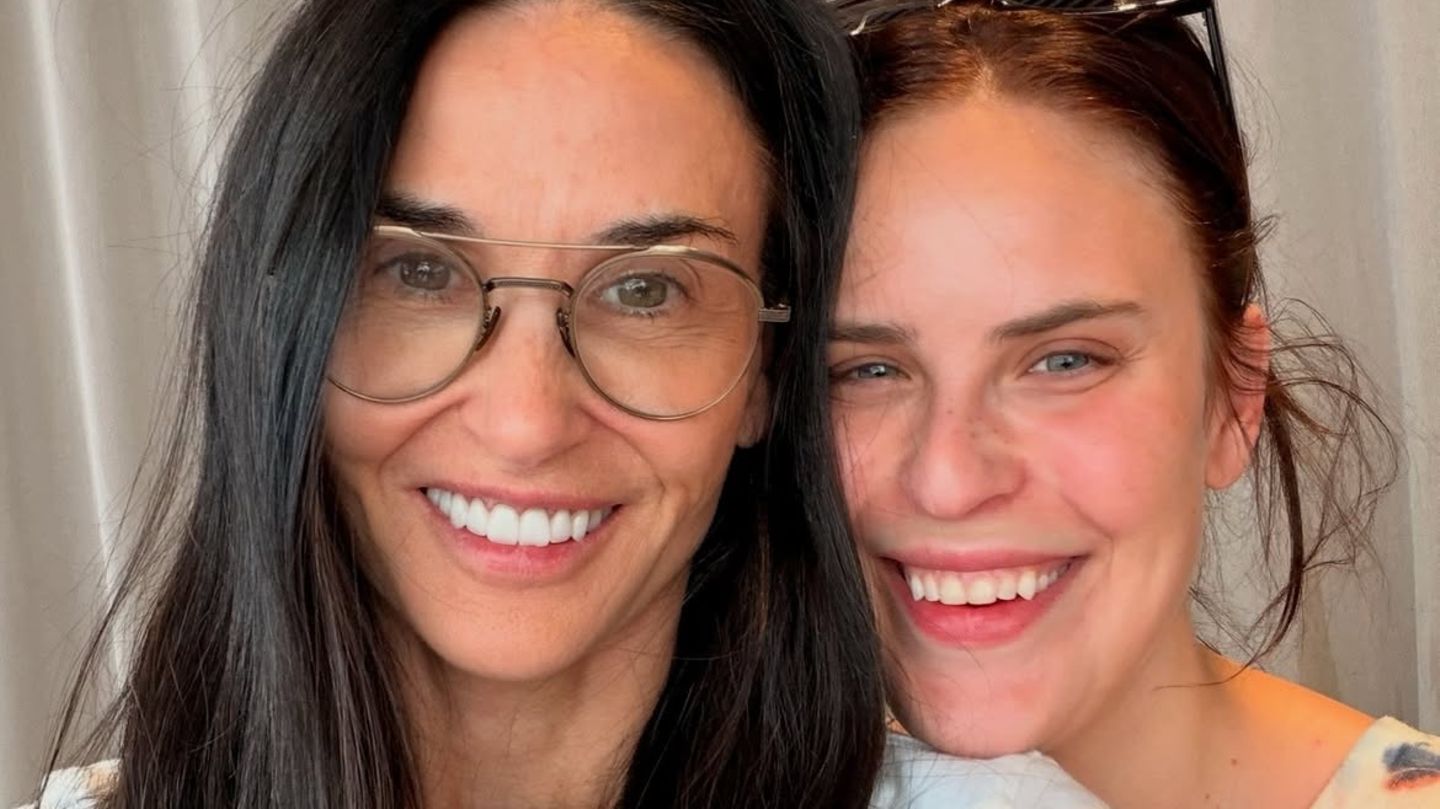 Ungeschminkt: Dieser Glow des Duos macht Make-up überflüssig