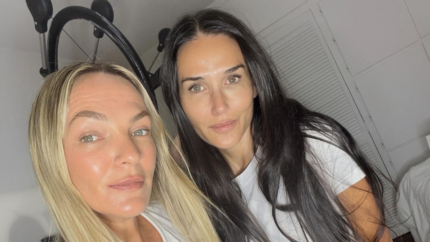 Ungeschminkt: Stars ohne Make-up | GALA.de